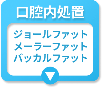 口腔内処置 ジョールファット メーラーファット バッカルファット