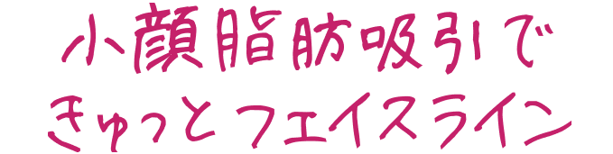 小顔脂肪吸引できゅっとフェイスライン