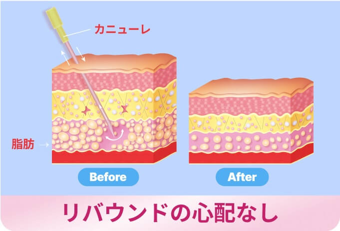 リバウンドの心配なし