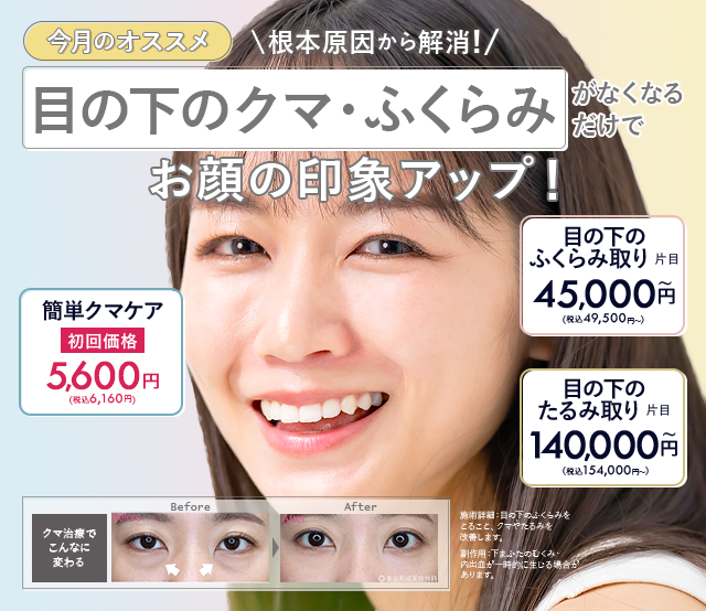 クマ治療特集｜美容整形のことなら東京形成美容外科・美容皮膚科