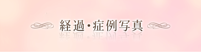症例写真 美容整形のことなら千葉県船橋市の東京形成美容外科 美容皮膚科 船橋駅から徒歩3分