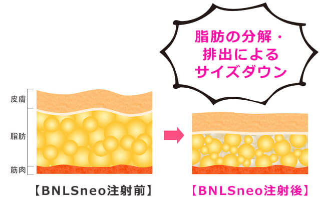 BNLSneo注射前後の脂肪細胞のイラスト