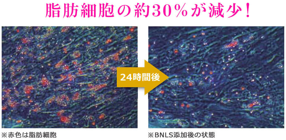 BNLSneoによる脂肪細胞減少の図、脂肪細胞の約30％が減少！