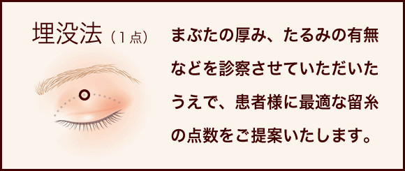 切らずに憧れの二重！メスを使わないので、ダウンタイムも短い ／徹底した痛み対策！超極細針を使用／抜糸がいらない！通院不要