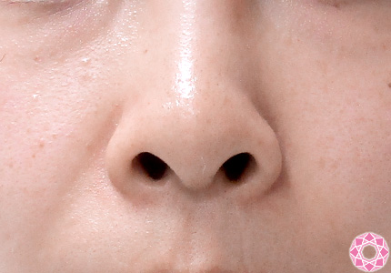 変わる 形 鼻 の 鼻は一生成長し続ける？鼻の成長期はいつ？