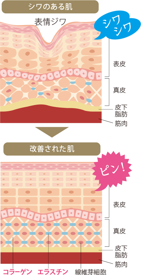 美容外科注入治療 スネコス注射の費用・効果・副作用について｜切らない目の下の