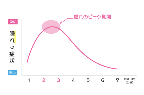 腫れが続くのは1週間前後