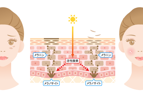 シミができる仕組みイラスト