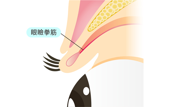 眼瞼下垂はこの眼瞼挙筋の機能障害が原因で起こる