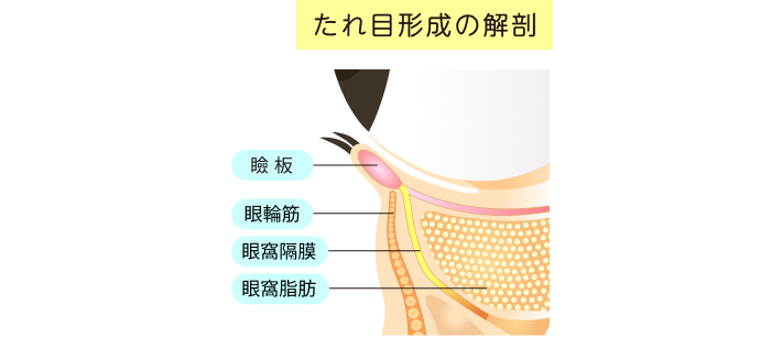 たれ目形成の解剖