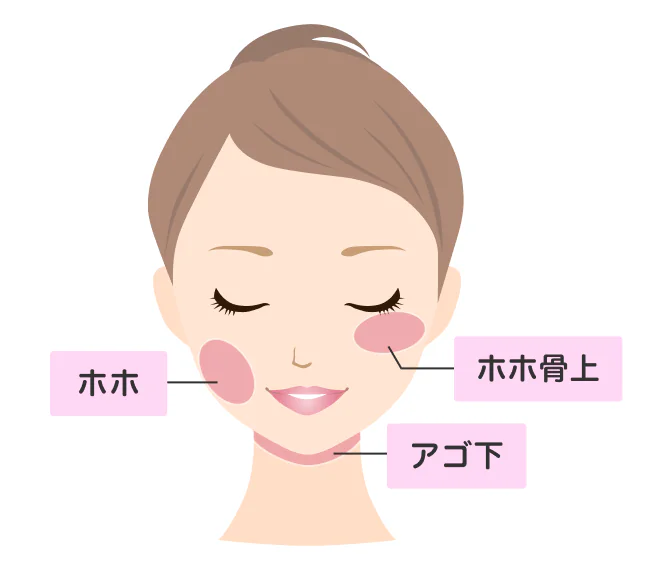 顔の脂肪吸引の適応部位