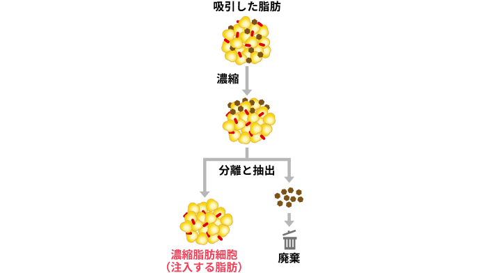 脂肪細胞を精製する過程
