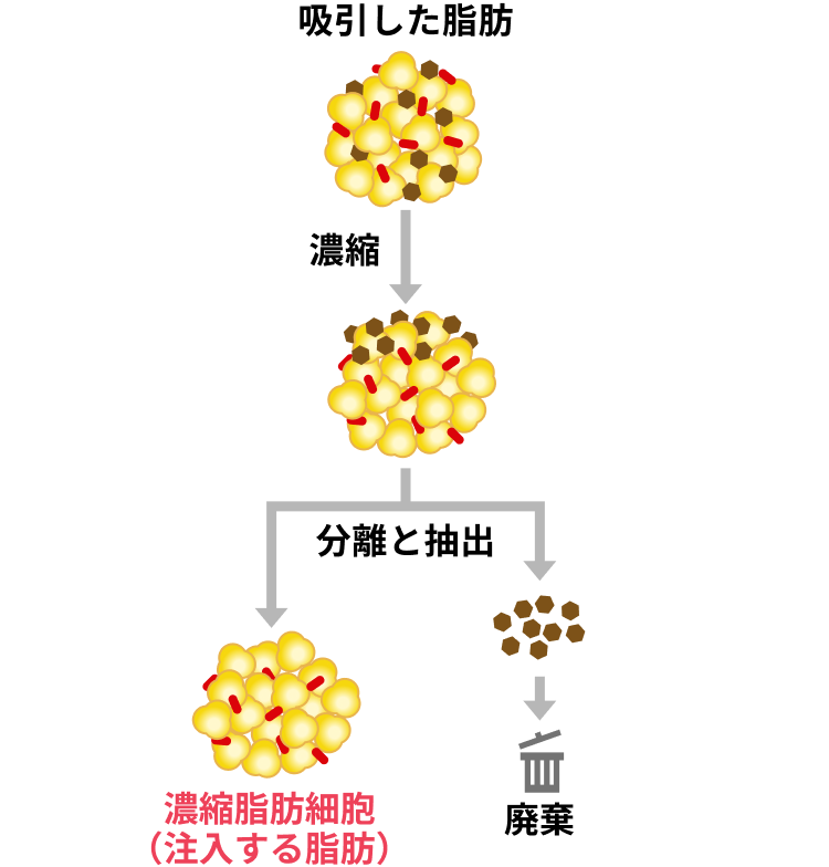 脂肪細胞を精製する過程