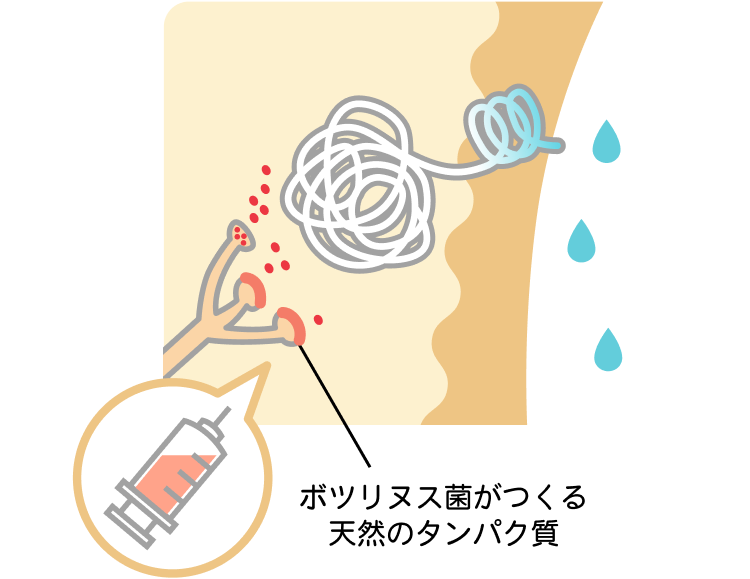 多汗症になる仕組み