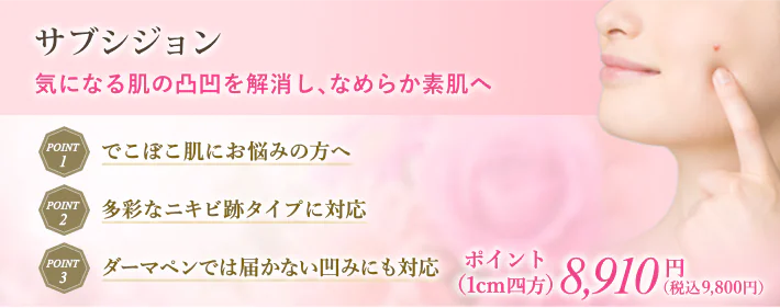 サブシジョン