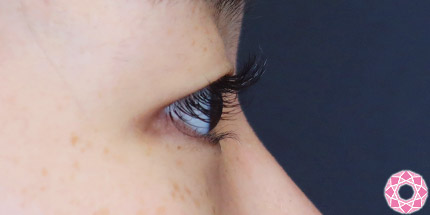 年代：20代 施術名：二重埋没法 施術前｜【公式】東京形成美容外科