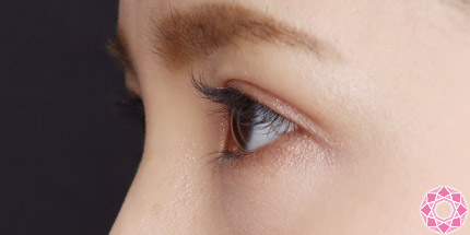 年代：20代 施術名：二重埋没法 施術後｜【公式】東京形成美容外科