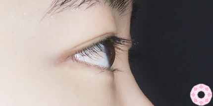 年代：20代 施術名：二重埋没法 施術前｜【公式】東京形成美容外科