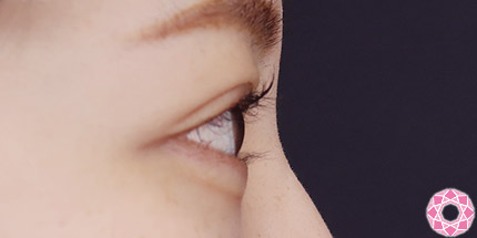 年代：20代 施術名：二重埋没法 施術前｜【公式】東京形成美容外科