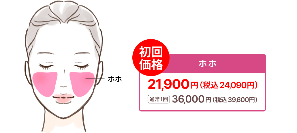 HIFU料金表